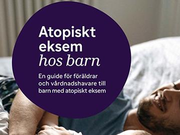Atopiskt eksem hos barn