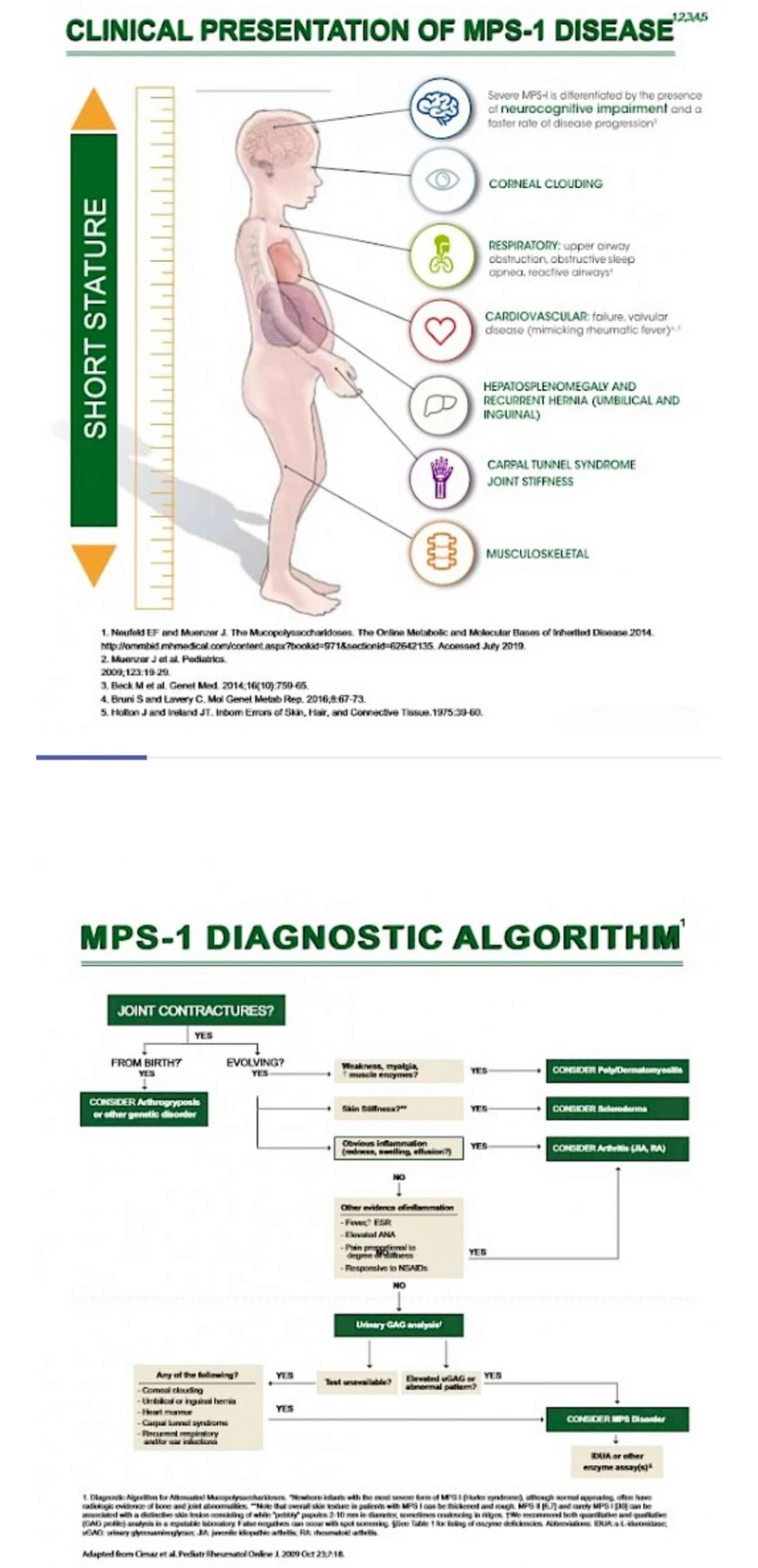 How to diagnose MPS I Disease