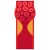 Trombóza
