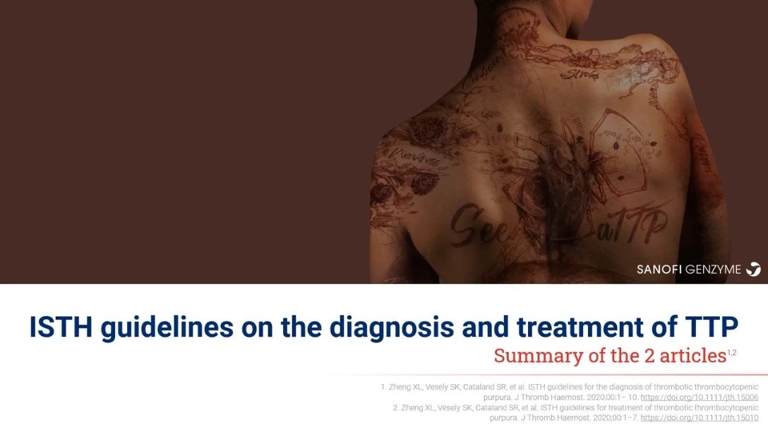 ISTH guidelines on the diagnosis and treatment of TTP