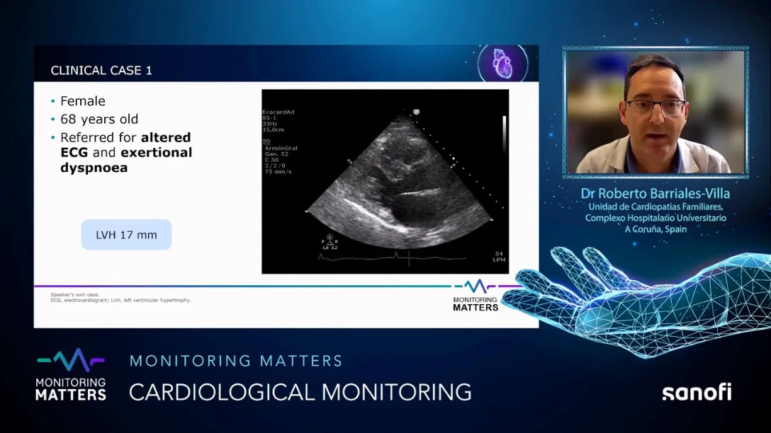 Monitoring Matters Video 2 section 2