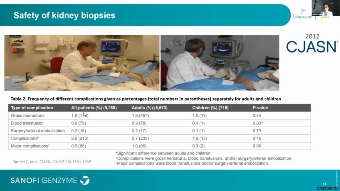 Tondel C. - Clinical relevance of kidney biopsies in Fabry Disease