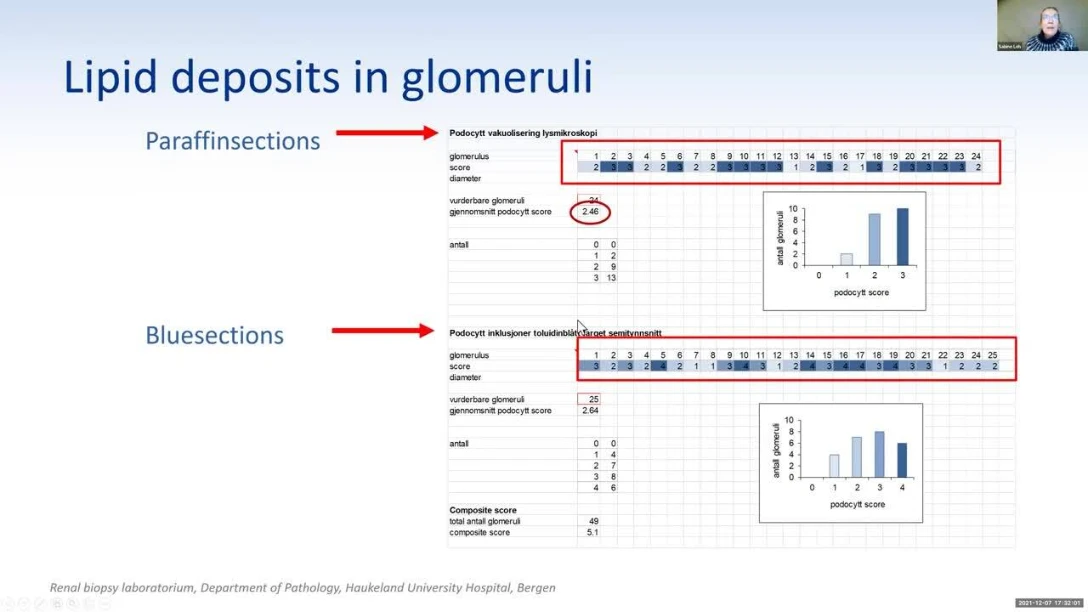 Leh S. - Pathology management and scoring of kidney biopsies in Fabry disease