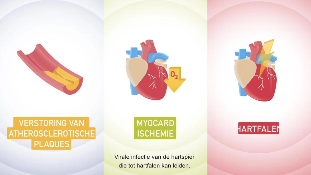 01_MONTAGE SANOFI_Flemish_ST_2