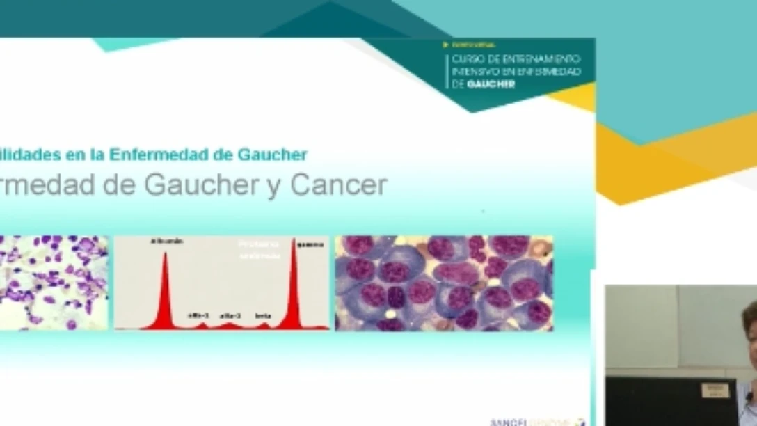 Dra Dragosky - Gaucher y Cancer