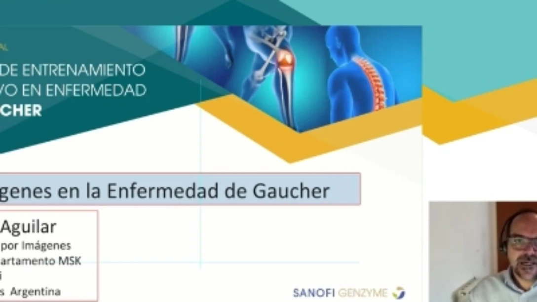 Dr Gabriel Aguilar - Imágenes en la enfermedad de Gaucher