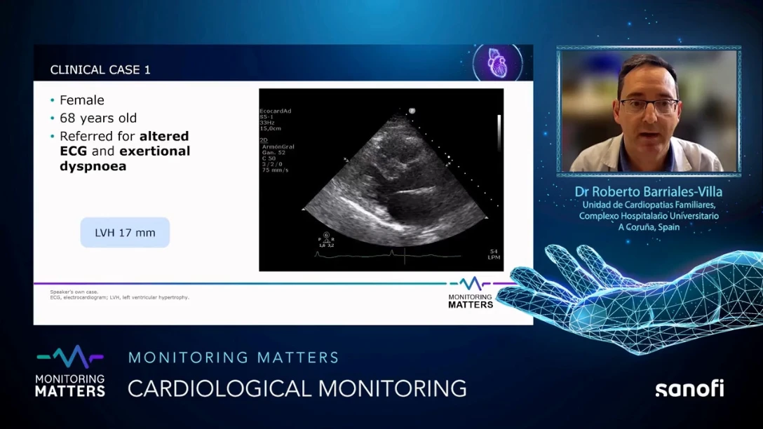 Monitoring Matters Video 2 section 2