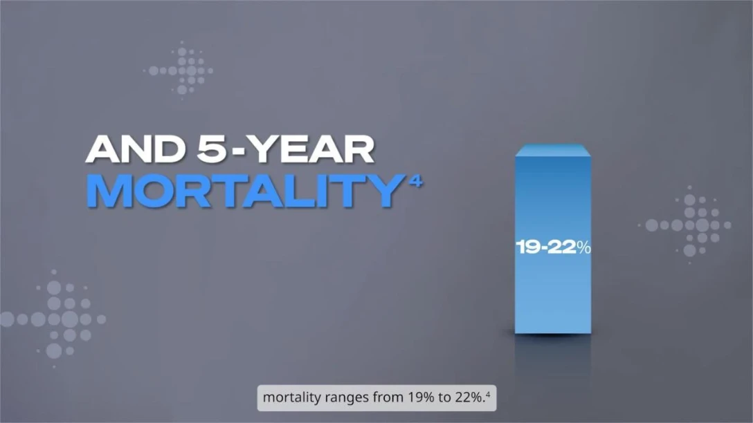 Sanofi_Praluent_KOL_Video_1_(1)