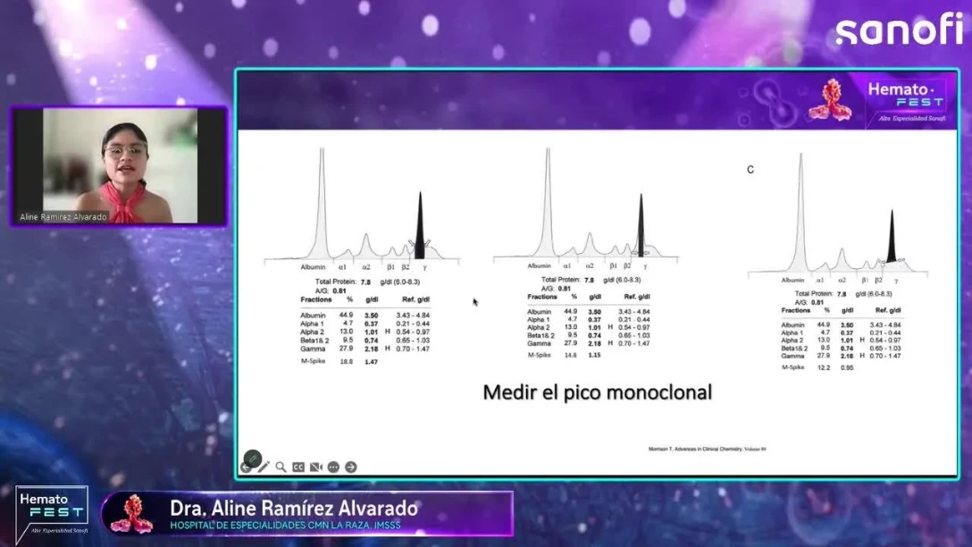 Mieloma Múltiple en recaída y refractariedad