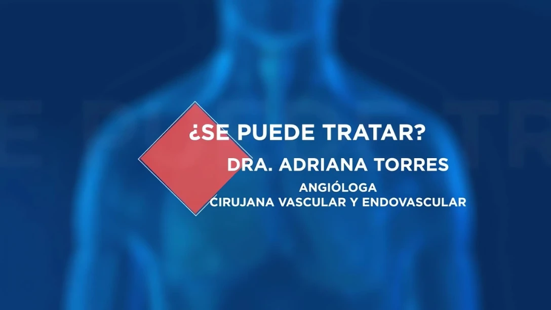 Trombosis - ¿Se puede tratar? (3:38)