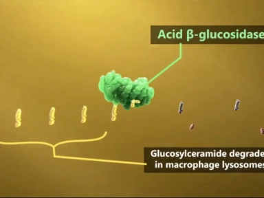 Enzimpótló és szubsztrát-redukciós terápia 1-es típusú Gaucher-kórban