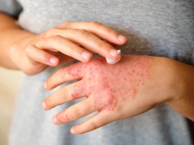 Proven Efficacy of Dupixent® in COPD