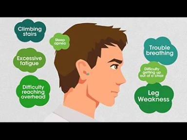 Navigating the Pompe Disease Journey