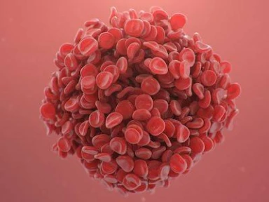 Treatment Algorithm in Cancer-Associated Thrombosis: Updated Canadian Expert Consensus Related RAM: Khorana RAM