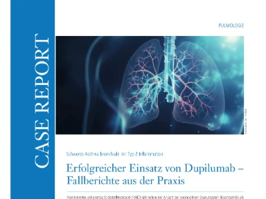 Case Cards Asthma bronchiale Dupilumab