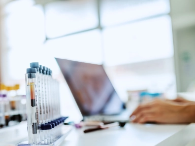 An update review of post-transplant diabetes mellitus: Concept, risk factors, clinical implications and management