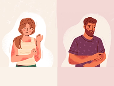 First step: Diagnosis of Prurigo Nodularis