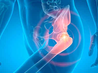 Het JUISTE antwoord is...