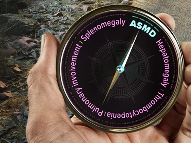 ASMD (Acid sphingomyelinase deficiency)