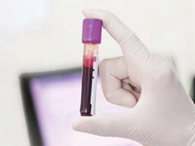 Lyso-GL-1: specifieke biomarker voor de ziekte voor gaucher¹