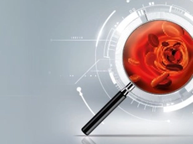 Sherlock Holmes in Rare Hematology