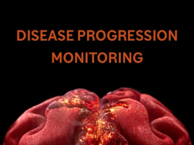 Disease Progression Monitoring