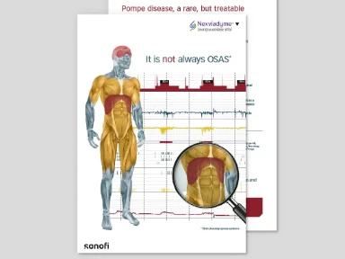 Nexviadyme® - It is not always OSAS
