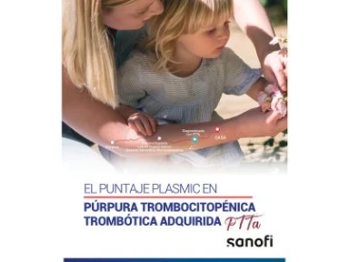 El Puntaje Plasmic en Púrpura Trombocitopénica Trombótica Adquirida