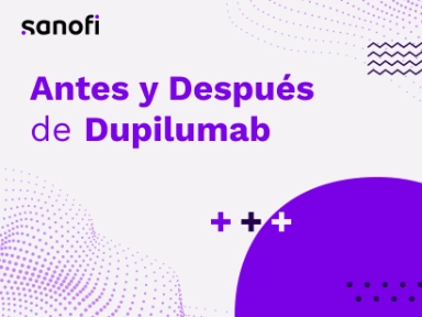  Caso Clínico en vida real, un antes y un después con Dupilumab