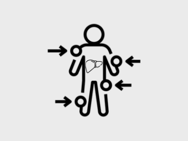 Hepatólogos y gastroenterólogos: diagnóstico de ASMD