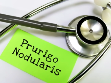 Dupixent v indikaci prurigo nodularis