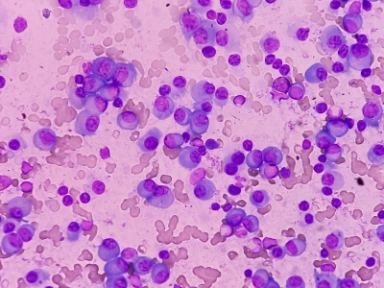 Studie IMROZ u Ti NDMM