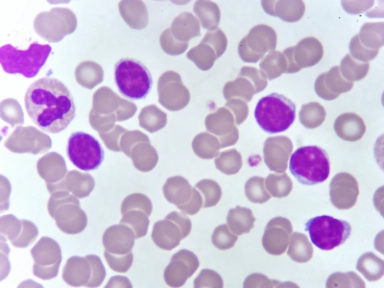 Symposium COMy 2024: Going for Gold - Making Strides in Multiple Myeloma Treatment Strategies