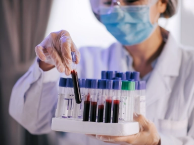 Výsledky projektu  CRAB II  České myelomové skupiny