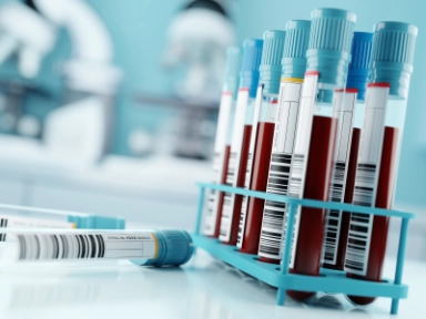 D-dimery a jejich využití v klinické praxi