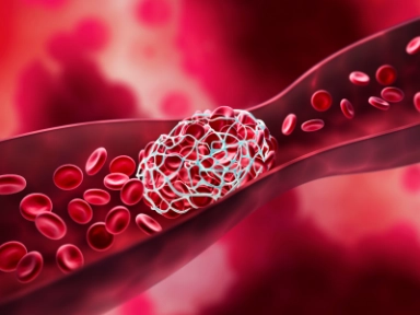 Výskyt rizikových faktorů spojených s žilním tromboembolismem u pacientů s karcinomem plic, kteří dostávají inhibitory kontrolních bodů imunity