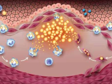  Léčba dyslipidemie: Jak daleko je teorie od praxe?