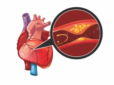 Bezpečnost inhibitorů PCSK9