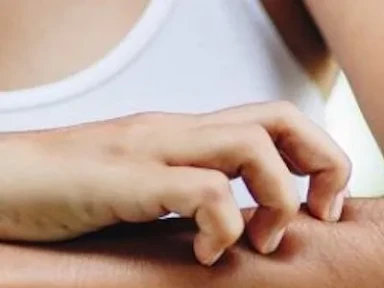 Atopická dermatitida: praktický průvodce onemocněním i léčbou