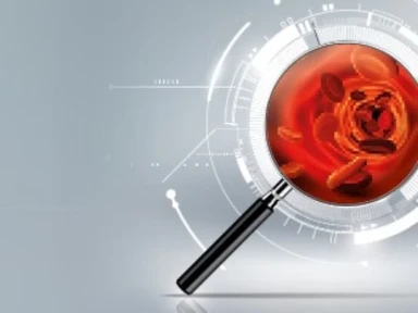 Sherlock Holmes in Rare Hematology