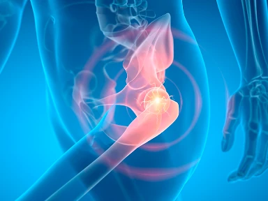 Addressing Bone Disease in Lysosomal storage diseases