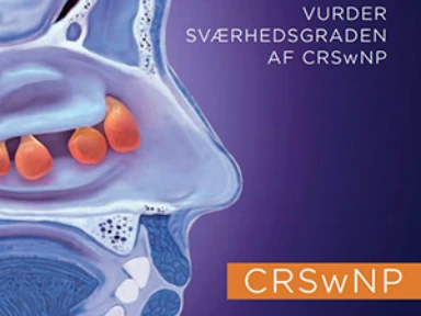 CRSwNP - de forskellige rating scales: Folder med oversigt over de forskellige ratings scales inden for kronisk rhinosinuitis med næsepolypper