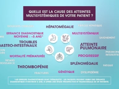 Vidéo sur ASMD en 4 min