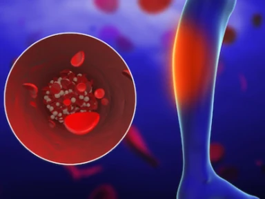 Τρόπος εντοπισμού των ασθενών που πρόκειται να εμφανίσουν ΟΣΣ