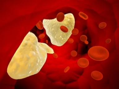 Χρήση των αναστολέων PCSK9 στην κλινική πρακτική: Η μελέτη AT-TARGET-IT