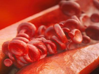 ΟΔΗΓΙΕΣ ΓΙΑ ΤΗΝ ΑΝΑΣΥΣΤΑΣΗ ΚΑΙ ΤΗ ΧΟΡΗΓΗΣΗ ΤΟY CABLIVI®