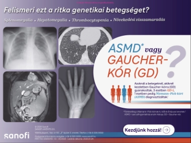 ASMD/Gaucher-kór differenciálás