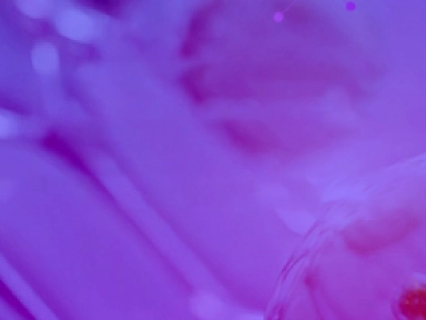 מה חשוב לדעת על דלקת עור אטופית?