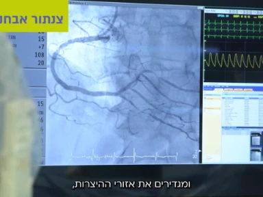 צנתור אבחוני וטיפולי למחלת טרשת העורקים