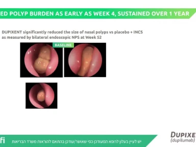 LIBERTY SINUS study (CRSwNP)